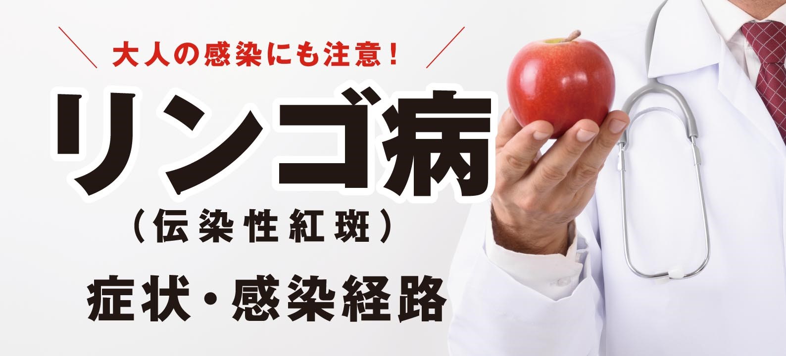 リンゴ病（伝染性紅斑）の症状・感染経路は？大人の感染にも注意